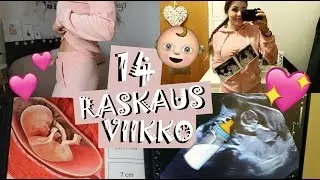 RASKAUSJUTTUJA JA NISKAPOIMU-ULTRASSA | MYDAY