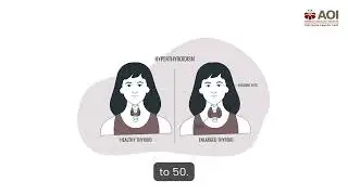 Papillary Thyroid Cancer | Symptoms, Causes, Treatment & Prognosis | AOI