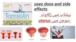 Tamsolin ,Maxflow ( Tamsulosin HCl ) tabs uses , dose and side effects