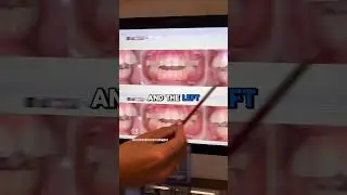Thumb Sucking Can CAUSE THIS! - Dr. Murthy