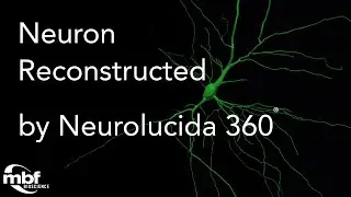 Captivating Neuron Reconstruction