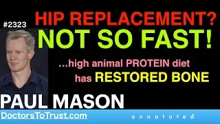 PAUL MASON  |  HIP REPLACEMENT? NOT SO FAST!  &hellip;high animal PROTEIN diet has RESTORED BONE