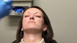 BOTOX treatment at CEENTA