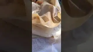 стома