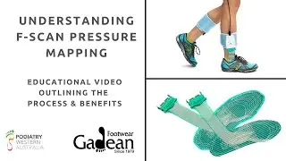 F-Scan Pressure Mapping