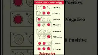 Blood group chart dekh kr pehchaan kare kon sa group he