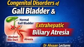 Congenital Disorders of Gall Bladder |Extrahepatic Biliary Atresia |Hepatobiliary Surgery