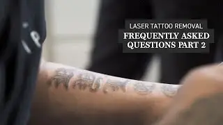 Laser Tattoo Removal Frequently Asked Questions - Part 2 | Victorian Dermal Group