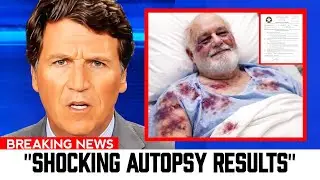 THIS IS DISTURBING! Shocking Details Revealed in Rob Reiner&rsquo;s Autopsy Report