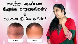 Neck Darkness Removal | Home Remedy | கழுத்தில் உள்ள கருமை நீங்க டிப்ஸ் #darkneck #beautytips