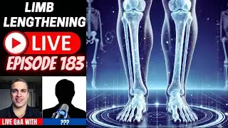 Limb Lengthening LIVE Ep. 183 – Patient Discussions