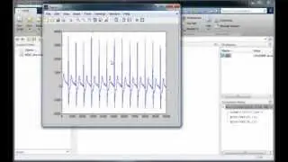 Video1-(ECG Signal) Where could you find and how can load that in MATLAB