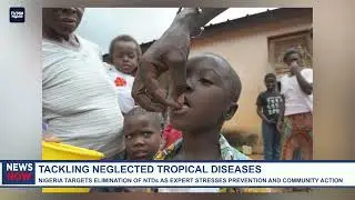 Nigeria Targets elimination of NTDs as expert stresses prevention and community action