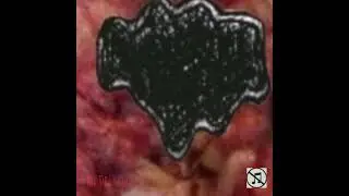 PVXBR - THE DRS IN (FULL) #grind #noisegrind #goregrind
