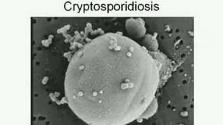 Opportunistic Infections