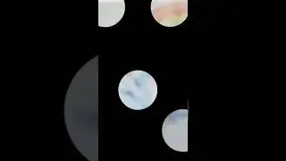 Nurses day whatsapp status Happy Nurses 🥰🥰
