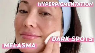 Dark Spot Treatments: Products I Love for Melasma & Hyperpigmentation | Skincare with @Susan Yara