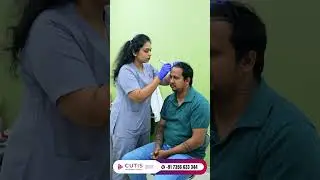 Revitalize Your Look: Hair Transplant Journey at Cutis International