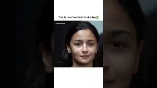 Real skin looks like this✅ Comment below!!#shorts #bollywood#aliabhatt #celebrity #celebrityskin