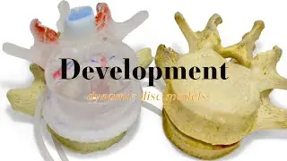 Dynamic Disc Model Development