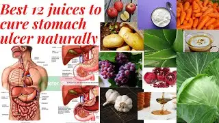 Best 12 Juices to cure Stomach Ulcer naturally
