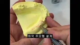 3  하악 주모형 설계10분 16초