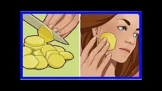ESSAYEZ CECI SI VOUS AVEZ TACHES SOMBRES, TEINT IN&Eacute;GAL ET HYPERPIGMENTATION