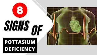 Potassium Deficiency : 8 Warning Signs That You Have Low Pottasium