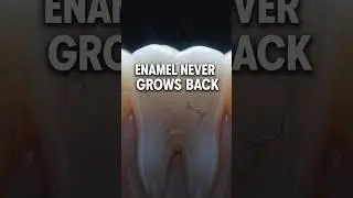 This Habit Is Ruining Your Tooth Enamel