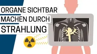 Wie funktioniert eine Computertomografie (CT)?