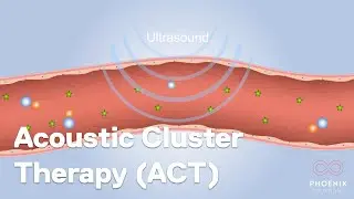 World first treatment with ‘acoustic cluster therapy’ to improve chemotherapy delivery