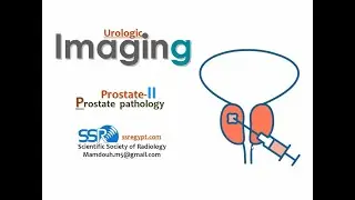 11- Urinary imaging Prostate (IIb)  - Prof  Dr  Mamdouh Mahfouz