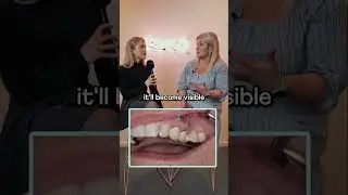 How long does a dental bridge last? #dentist #qanda #dental #bridge #lifespan #health #gums