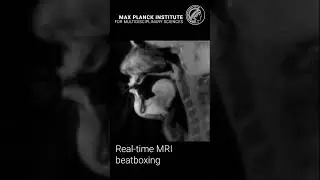 Beatboxing real-time #MRI