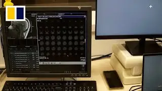 Using AI to read minds through brain scans