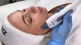 Ultrasound Skin Scrubber | Skin Exfoliation | Blackheads Reduction | Zemits Skin Expert
