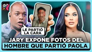 JARY RAMÍREZ REVELA MARIDO DE PAOLA CRISTAL TEME POR SU VIDA “LE PARTIÓ LA CABEZA”