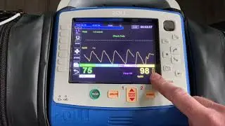 ZOLL X Series Perfusion Index-ZOLL Tips and Tricks