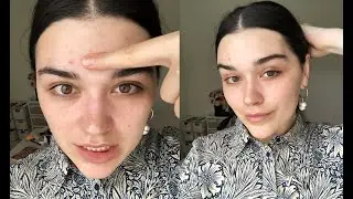 Is All Natural Good? Skincare First Impressions