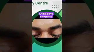 Best Artificial eye lab in Bangladesh
