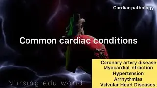 Common cardiac conditions| CAD ,MI&hellip;etc| medical notes|medical