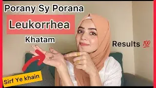 Magical Leukorrhea Treatment 2022 | Results Guaranteed ❤️ | Dietitian Aqsa