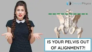 Is Your Pelvis Out of Alignment?! | Expert Explains!