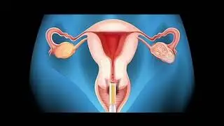 Rediscover Feminine Wellness with Vaginal Repair Serum!