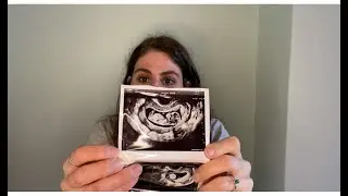 ¡Embarazada! Primer trimestre. Mi experiencia tras varios abortos.