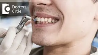 What causes bleeding gums and how to manage it? - Dr. Aniruddha KB
