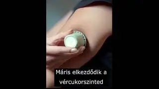 LinX CGM v&eacute;rcukorm&eacute;rő szenzor bemutat&oacute;
