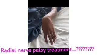 radial nerve palsy / wrist drop treatment  / tendon transfer surgery for radial nerve palsy
