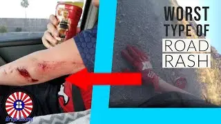 Bootleg Canyon MTB - Worst Crash of My Season!?!