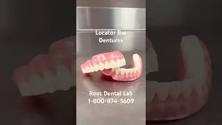 Locator Bar Dentures! #dentist #dentures #teeth #dentallab #denturegang #cosmeticdentistry #doctor